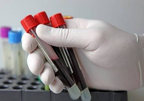 上海代怀机构：﻿取卵后腹水多久能消失？用这些方法能够加快腹水的消失