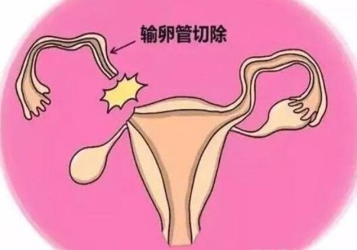上海代怀代生公司：﻿男性睾丸受伤之后对生育带来的影响要视伤情的严重程度来决定